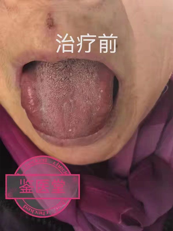 患者治疗前后对比