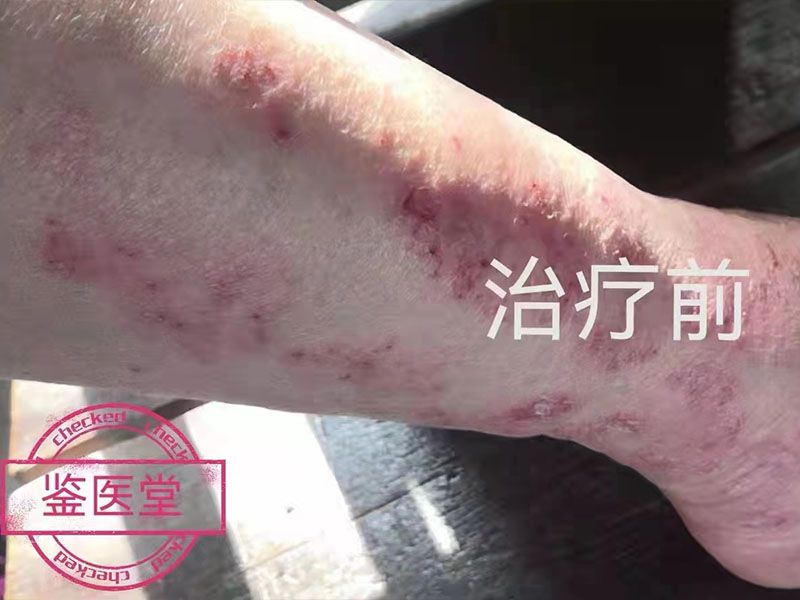 患者治疗案例